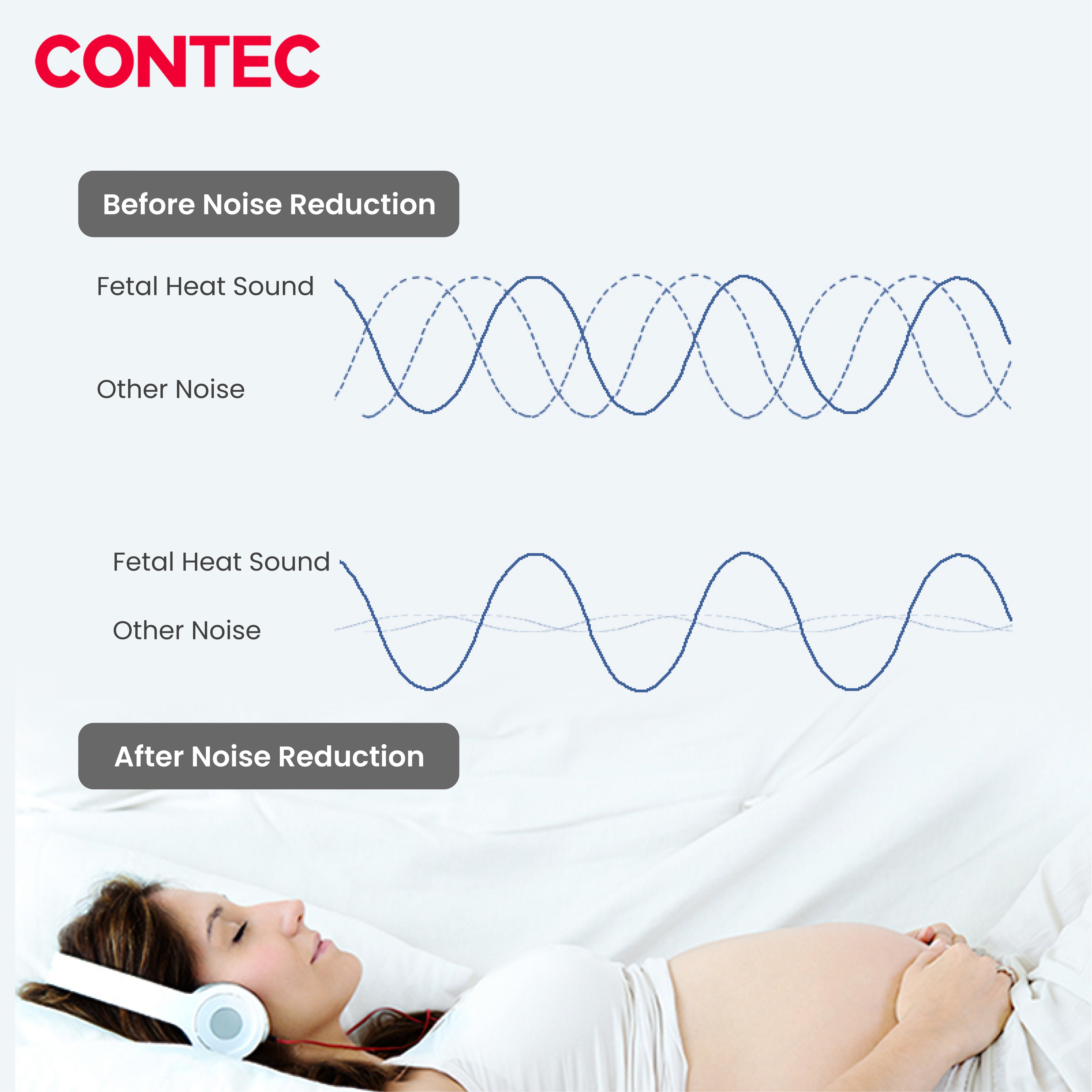 CONTEC10B Pocket Fetal Doppler – Portable Fetal Heart Rate Monitor.