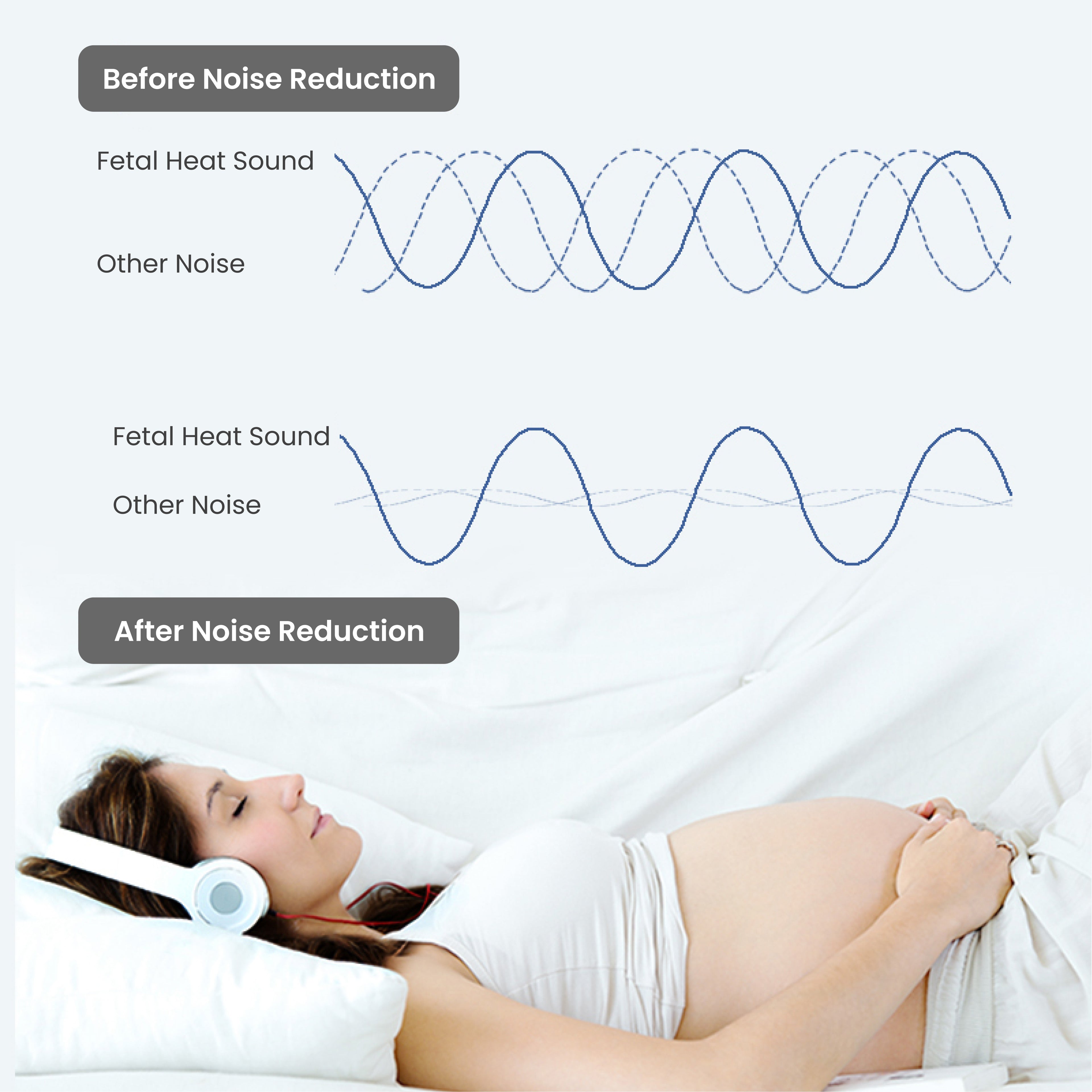CONTEC10B Pocket Fetal Doppler – Portable Fetal Heart Rate Monitor.